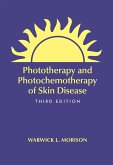 Phototherapy and Photochemotherapy for Skin Disease