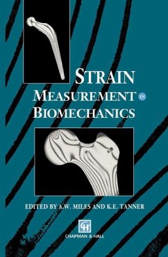 Strain Measurement in Biomechanics - Miles, A.W. / Tanner, K.E. (Hgg.)