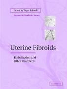 Uterine Fibroids - Tulandi, Togas (ed.)
