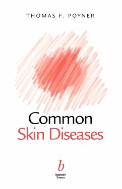 Common Skin Diseases - Poyner, Thomas