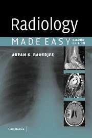 Radiology Made Easy - Banerjee, Arpan K