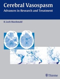 Cover Cerebral Vasospasm