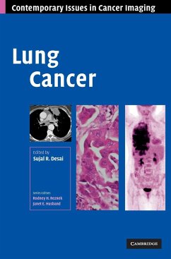 Lung Cancer - Desai, Sujal R. (ed.)