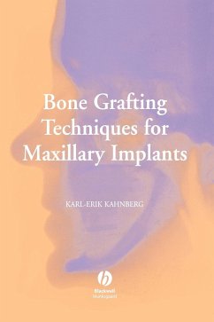 Bone Grafting Techniques for Maxillary Implants - Kahnberg, Karl-Erik