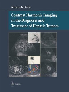 Contrast Harmonic Imaging in the Diagnosis and Treatment of Hepatic Tumors - Kudo, Masatoshi