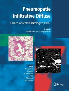 Pneumopatie Infiltrative Diffuse - Maffessanti, Mario / Dalpiaz, Giorgia / Cancellieri, A. / Pesci, A. / Polverosi, R. / Zompatori, M. (eds.)