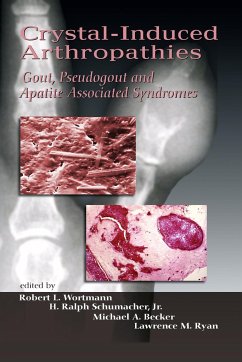 Crystal-Induced Arthropathies - Becker, Michael A. / Schumacher, Ralph H. / Wortmann, Robert L. (eds.)