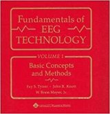 Fundamentals of Eeg Technology Fundamentals of Eeg Technology