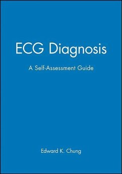 ECG Diagnosis - Chung, Edward K