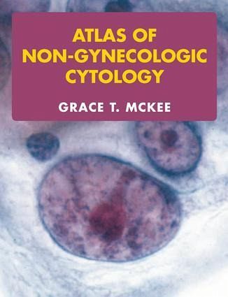 Atlas of Non-Gynecologic Cytology Atlas of Non-Gynecologic Cytology