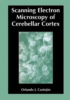 Scanning Electron Microscopy of Cerebellar Cortex - Castejón, Orlando