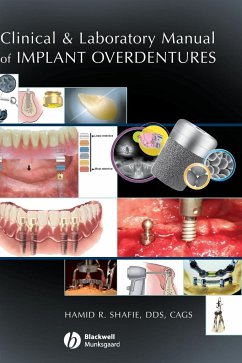 Clinical and Laboratory Manual of Implant Overdentures - Shafie, Hamid