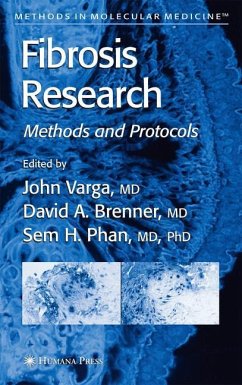 Fibrosis Research - Varga, John / Brenner, David A. / Phan, Sem H. (eds.)
