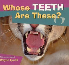 Whose Teeth Are These? - Lynch, Wayne