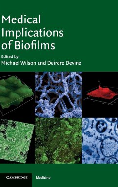 Medical Implications of Biofilms - Wilson, Michael / Devine, Deirdre (eds.)