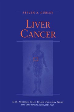 Liver Cancer - Curley, Steven A. (Hrsg.)