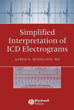 Simplified Interpretation of ICD Electrograms - Hesselson, Aaron B
