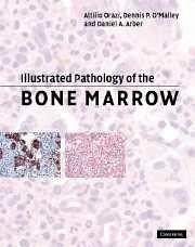 Illustrated Pathology of the Bone Marrow - Orazi, Attilio; O'Malley, Dennis P; Arber, Daniel A