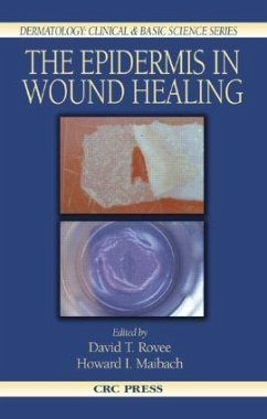 The Epidermis in Wound Healing - Maibach, Howard I. / Rovee, David T. (eds.)