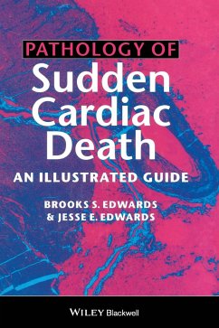 Pathology of Sudden Cardiac Death - Edwards, Brooks S; Edwards, Jesse E