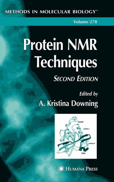 Protein NMR Techniques
