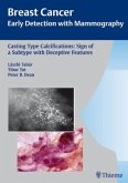 Casting Type Calcifications: Sign of a Subtype with Deceptive Features / Breast Cancer