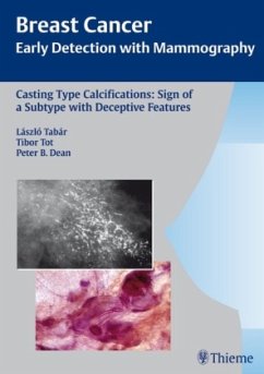 Casting Type Calcifications: Sign of a Subtype with Deceptive Features / Breast Cancer - Tabar, Laszlo;Tot, Tibor;Dean, Peter B.