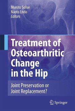 Treatment of Osteoarthritic Change in the Hip - Sofue, Muroto / Endo, Naoto (eds.)