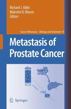 Metastasis of Prostate Cancer - Ablin, Richard J. / Mason, Malcolm D. (eds.)