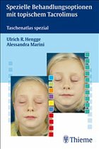 Cover Spezielle Behandlungsoptionen mit topischem Tacrolimus