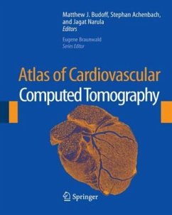 Atlas of Cardiovascular Computed Tomography - Narula, Jagat / Budoff, Matthew J. / Achenbach, Stephan (eds.)