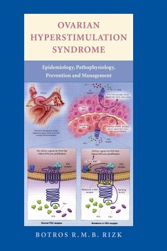 Ovarian Hyperstimulation Syndrome - Rizk, Botros R. M. B.