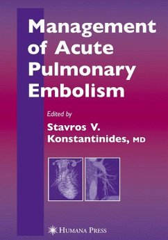 Management of Acute Pulmonary Embolism - Konstantinides, Stavros (ed.)