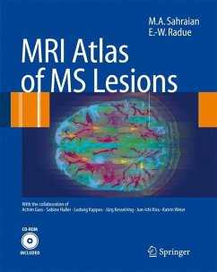 MRI Atlas of MS Lesions - Sahraian, Mohammad A.;Radue, Ernst-Wilhelm