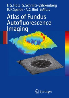 Atlas of Fundus Autofluorescence Imaging - Holz, Frank G. / Schmitz-Valckenberg, Steffen / Spaide, Richard F. / Bird, Alan C. (eds.)