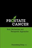 Prostate Cancer: Basic Mechanisms and Therapeutic Approaches