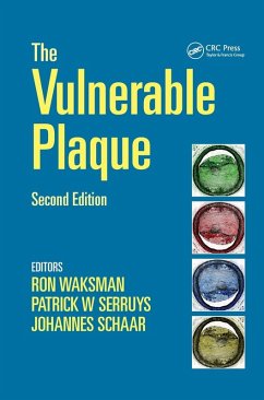 Cover Handbook of the Vulnerable Plaque