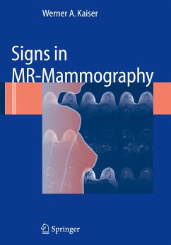 Signs in MR-Mammography - Kaiser, Werner A.