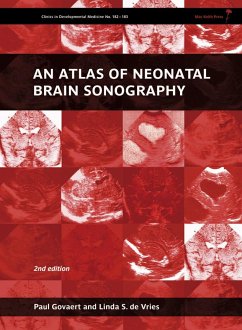 An Atlas of Neonatal Brain Sonography - Govaert, Paul; de Vries, Linda S.