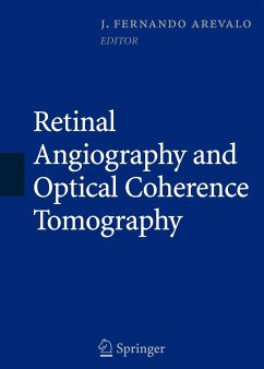 Retinal Angiography and Optical Coherence Tomography - Arevalo, J. Fernando (ed.)