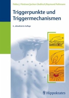 Triggerpunkte und Triggermechanismen - Pöntinen, Pekka J.;Gleditsch, Jochen;Pothmann, Raymund