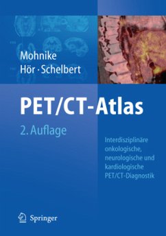 Oncologic and Cardiologic PET/CT-Diagnosis - Mohnike, Wolfgang / Hör, Gustav / Schelbert, Heinrich R. (eds.)