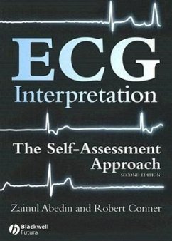 ECG Interpretation - Abedin, Zainul; Conner, Robert