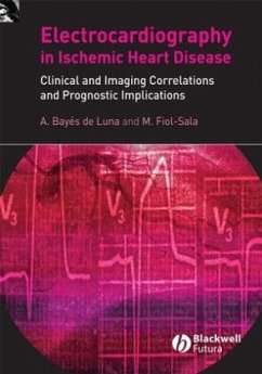 Electrocardiography in Ischemic Heart Disease - Bayés de Luna, Antoni;Fiol-Sala, Miquel