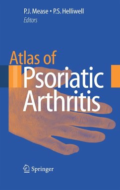 Atlas of Psoriatic Arthritis - Mease, MED (RHUUH), Philip J. (ed.-in-chief) / Helliwell, DM PhD FRCP, Philip S.