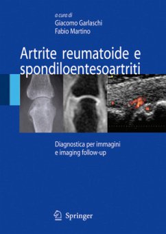 Artrite Reumatoide E Spondiloentesoartriti - Garlaschi, Giacomo / Martino, Fabio (eds.)