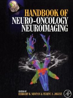 Handbook of Neuro-Oncology Neuroimaging - Newton, Herbert B. (ed.-in-chief) / Jolesz, Ferenc A.