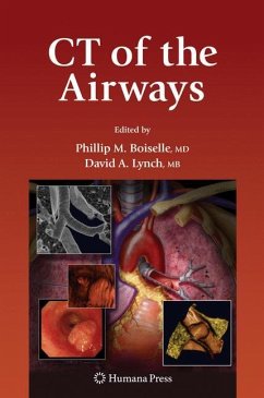 CT of the Airways - Boiselle, Phillip M. (ed.)