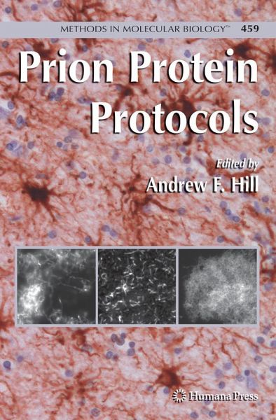 Prion Protein Protocols Prion Protein Protocols