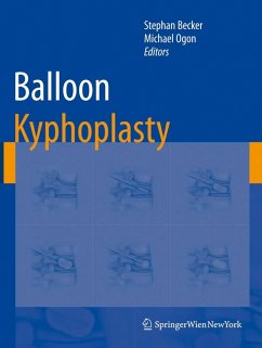 Cover Balloon Kyphoplasty